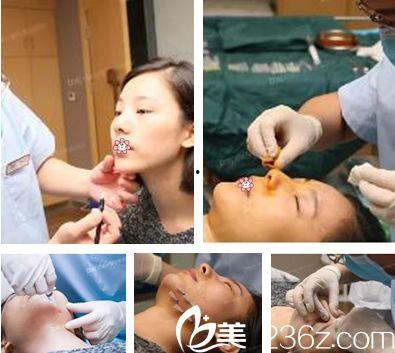 埋线隆鼻视频,视频教学带你轻松变美